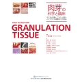 肉芽の科学と臨床 ペリオ・抜歯・エンド・GBR・インプラント周囲炎での対応
