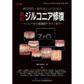 歯科医師・歯科技工士のための最新ジルコニア修復 インレーから前歯部クラウンまで QDT別冊