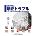 これで解決!矯正トラブル マウスピース型矯正、MTM、再治療等の"困った"事例に学ぶ予防と対処法