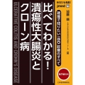 あなたも名医!比べてわかる!潰瘍性大腸炎とクローン病 jmed mook 77