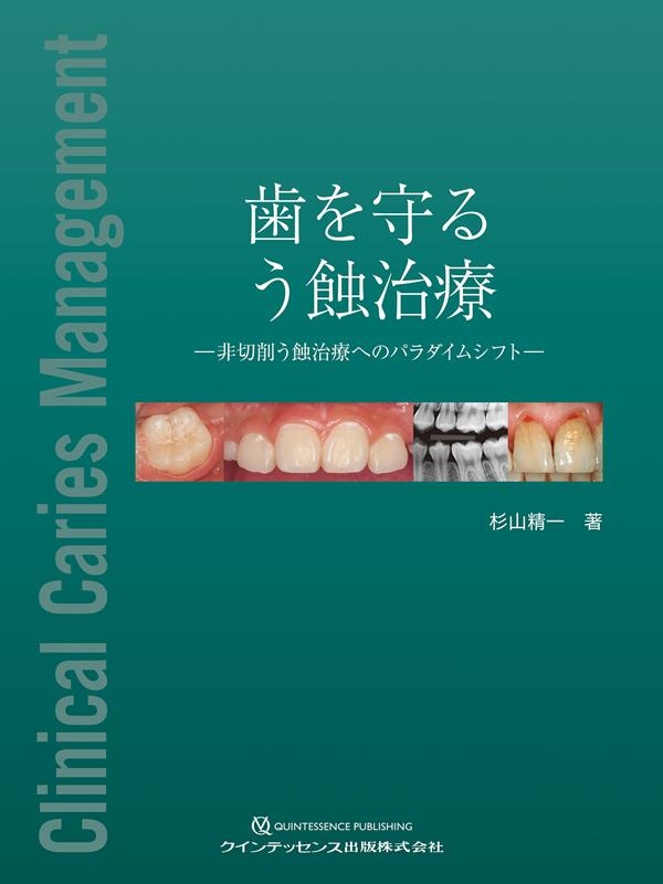 杉山精一/歯を守る う蝕治療 ─非切削う蝕治療へのパラダイムシフト─