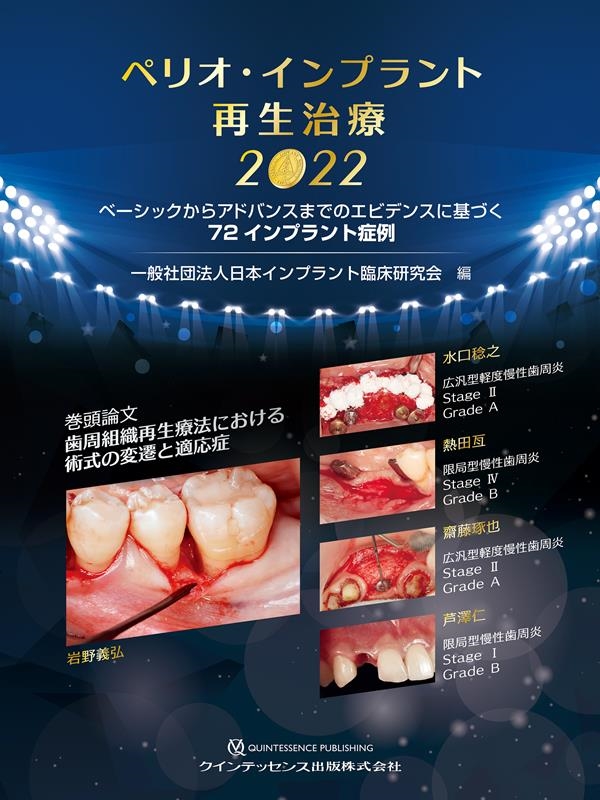 一般社団法人日本インプラント臨床研究会/ペリオ・インプラント再生