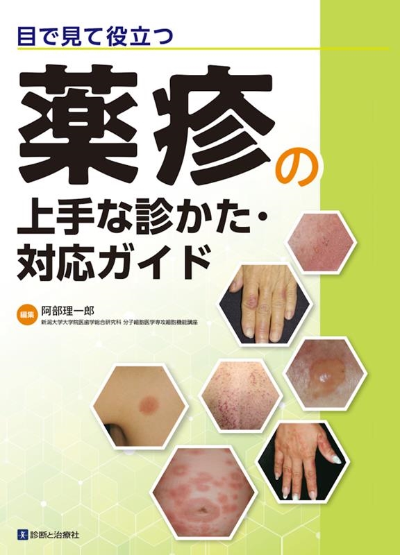 阿部理一郎/目で見て役立つ薬疹の上手な診かた・対応ガイド