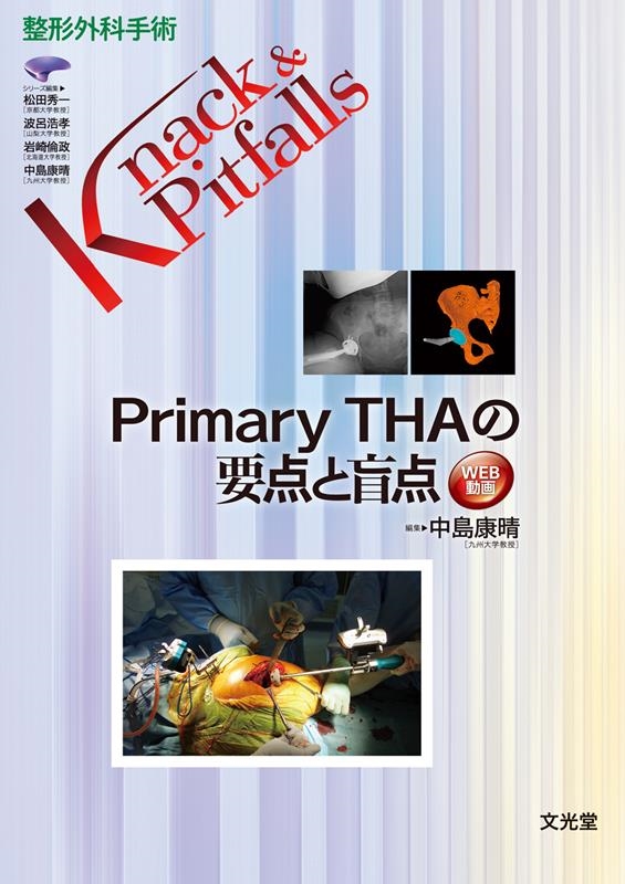 中島康晴/Primary THAの要点と盲点 整形外科手術Knack & Pitfalls