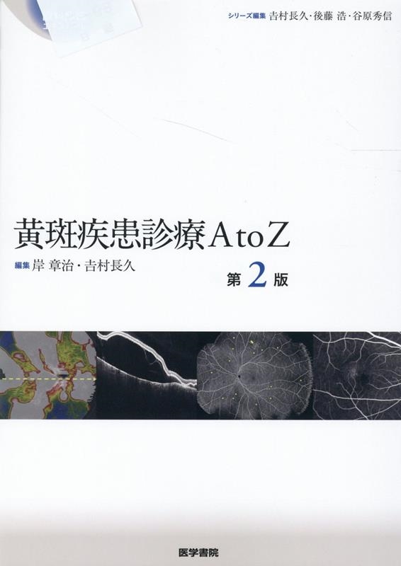 岸章治/黄斑疾患診療AtoZ 第2版 眼科臨床エキスパート