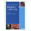 エビデンスとガイドラインに基づく脳動脈瘤とくも膜下出血