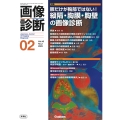 画像診断2023年2月号 Vol.43 No.2 肺だけが胸部ではない! 縦隔・胸膜・胸壁の画像診断