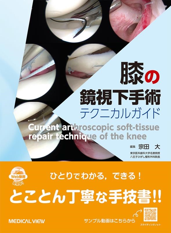 宗田大/膝の鏡視下手術テクニカルガイド