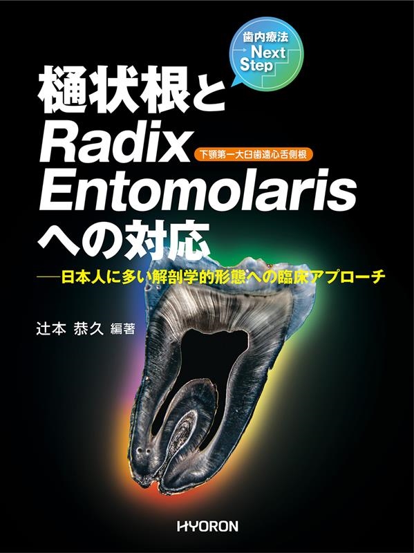 辻本恭久/歯内療法Next Step 樋状根とRadix Entomo 日本人に多い解剖学的形態への臨床アプローチ