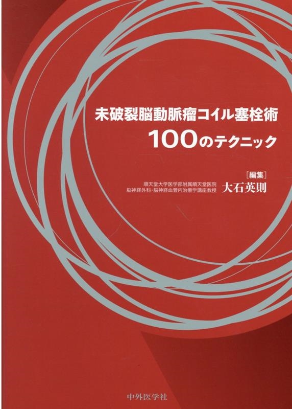 裁断済み】未破裂脳動脈瘤コイル塞栓術100のテクニック-eastgate.mk