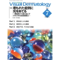 Visual Dermatology 2023年7月号 Vo 目でみる皮膚科学