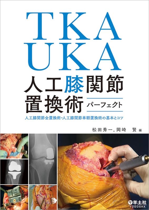 松田秀一/TKA・UKA人工膝関節置換術パーフェクト 人工膝関節全置換術・人工膝関節単顆置換術の基本とコツ
