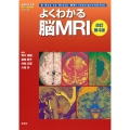 よくわかる脳MRI 改訂第4版 画像診断別冊KEY BOOKシリーズ