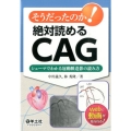 そうだったのか!絶対読めるCAG シェーマでわかる冠動脈造影の読み方