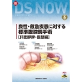 良性・救急疾患に対する標準腹腔鏡手術 肝胆膵脾・腹壁編 新DS NOW No. 6