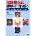 脳腫瘍外科経験したい手術16 スタンダードからアドバンス