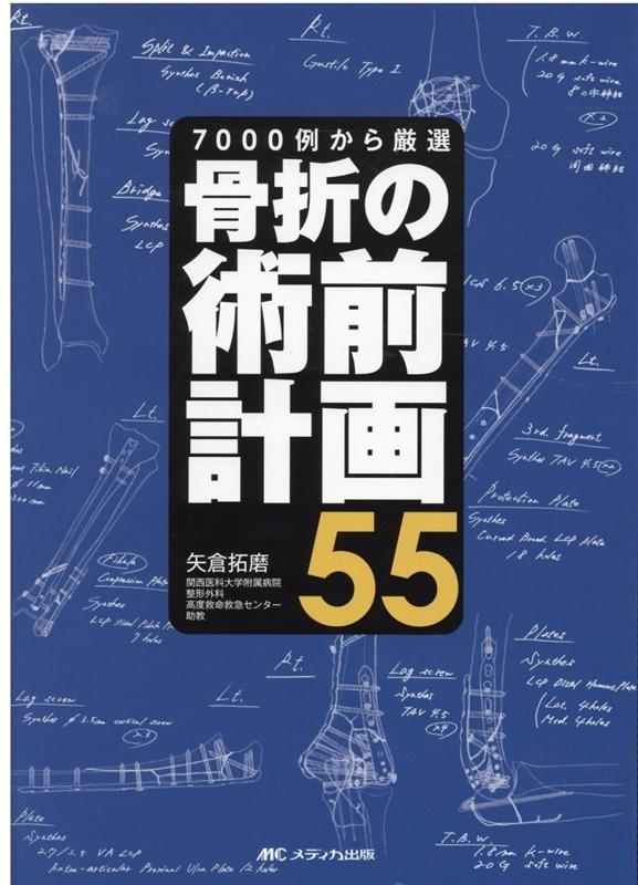 骨折の術前計画55｜Yahoo!フリマ（旧PayPayフリマ）
