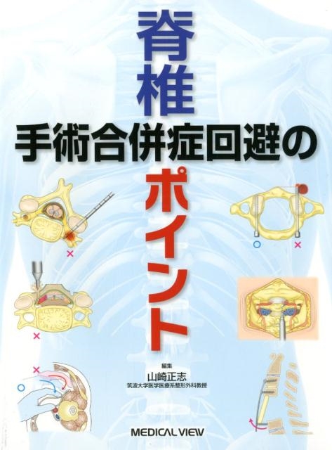 山崎正志/脊椎手術合併症回避のポイント