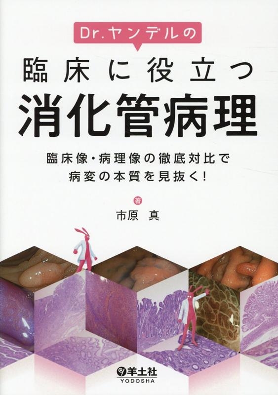 A12094235]Dr.ヤンデルの臨床に役立つ消化管病理?臨床像・病理像の徹底対比で病変の本質を見抜く! [単行本] 市原 真 - 医学