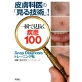 皮膚科医の「見る技術」!一瞬で見抜く疾患100 Snap Diagnosisトレーニング帖