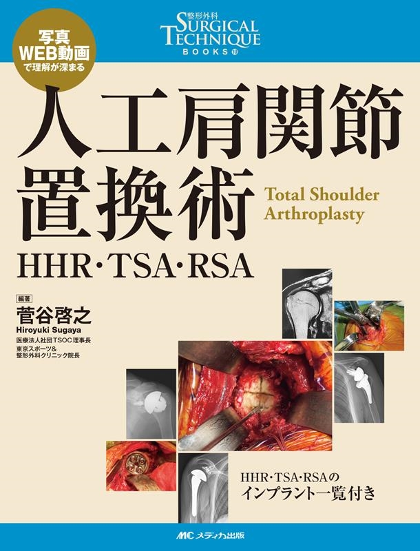 人工肩関節置換術: HHR・TSA・RSA (整形外科SURGICAL TECHNIQUE