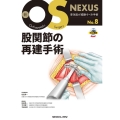 股関節の再建手術 新OS NEXUS No. 8