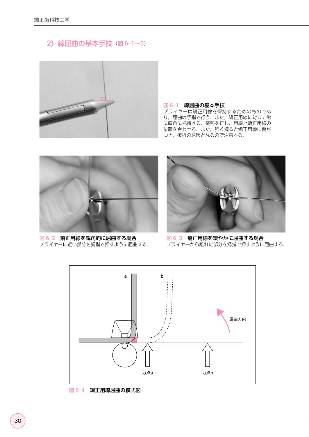 ホウ 少なかっ プライヤー 歯科 矯正 技工