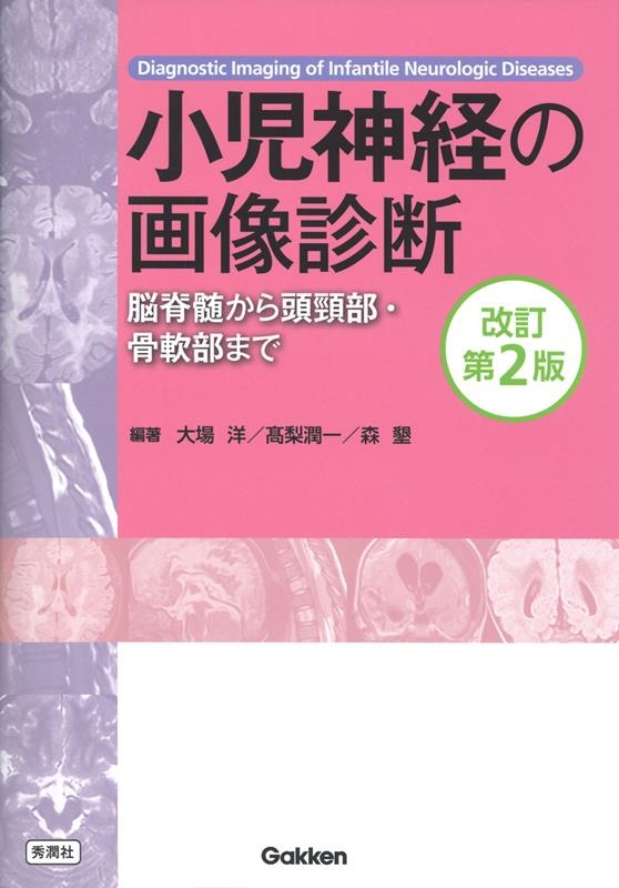 dショッピング |大場洋 「小児神経の画像診断 改訂第2版 ―脳脊髄から頭頸部・骨軟部まで―」 Book | カテゴリ：音楽 その他の販売できる商品  | タワーレコード (0086295527)|ドコモの通販サイト