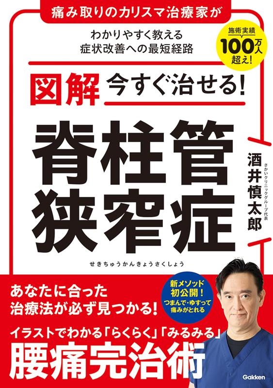 図解 今すぐ治せる! 脊柱管狭窄症 図解 今すぐ治せる! 脊柱管狭窄症