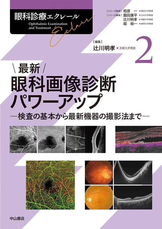 辻川明孝/最新眼科画像診断パワーアップ 検査の基本から最新機器の撮影法まで 眼科診療エクレール 2