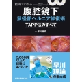 動画でわかる腹腔鏡下鼠径部ヘルニア修復術ーTAPP法のすべてー
