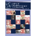 必ず上達 ソケットプリザベーション インプラント初心者でもできる骨造成