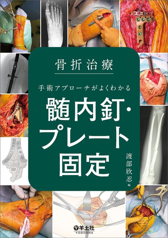 渡部欣忍/骨折治療 手術アプローチがよくわかる髄内釘・プレート固定