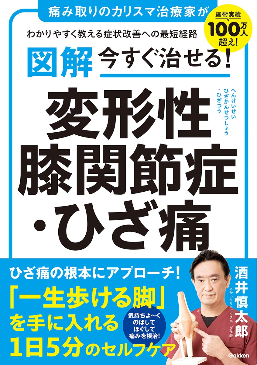 図解 今すぐ治せる! 変形性膝関節症・ひざ痛 図解 今すぐ治せる! 変形性膝関節症・ひざ痛