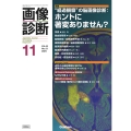 画像診断2024年11月号 Vol.44 No.13 "経過観察"の脳画像診断:ホントに著変ありません?