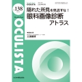 隠れた所見を見逃すな!眼科画像診断アトラス