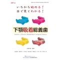 いちから始める! 目で見てわかる! 下顎吸着総義歯