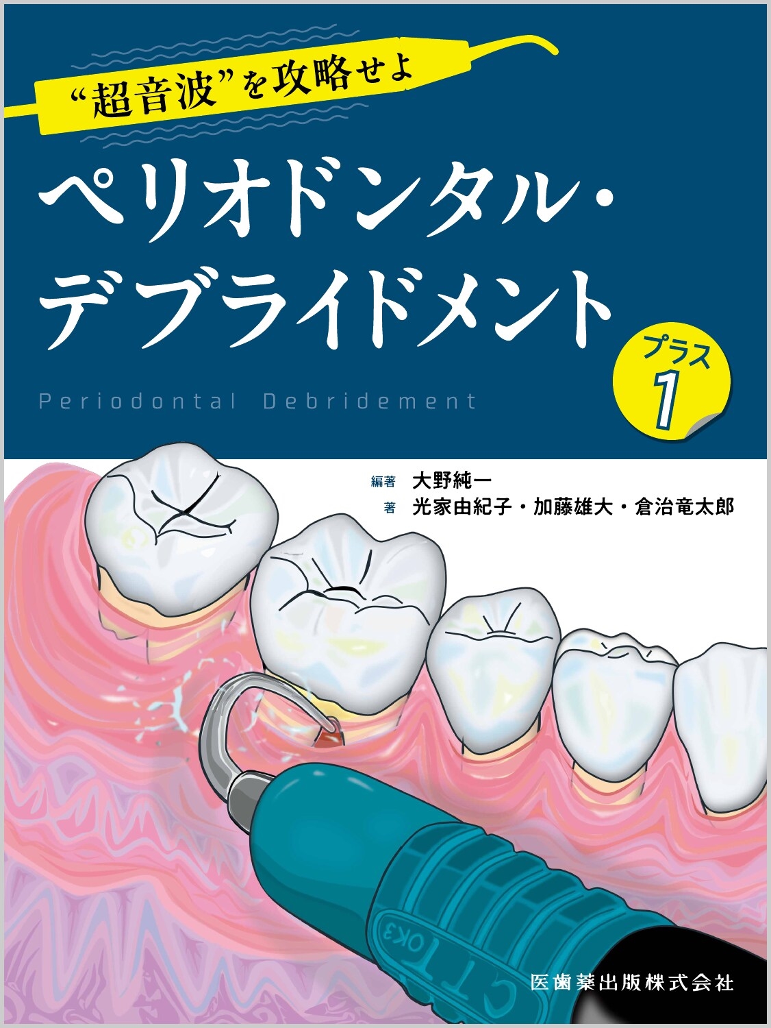 "超音波"を攻略せよ ペリオドンタル・デブライドメント プラス1
