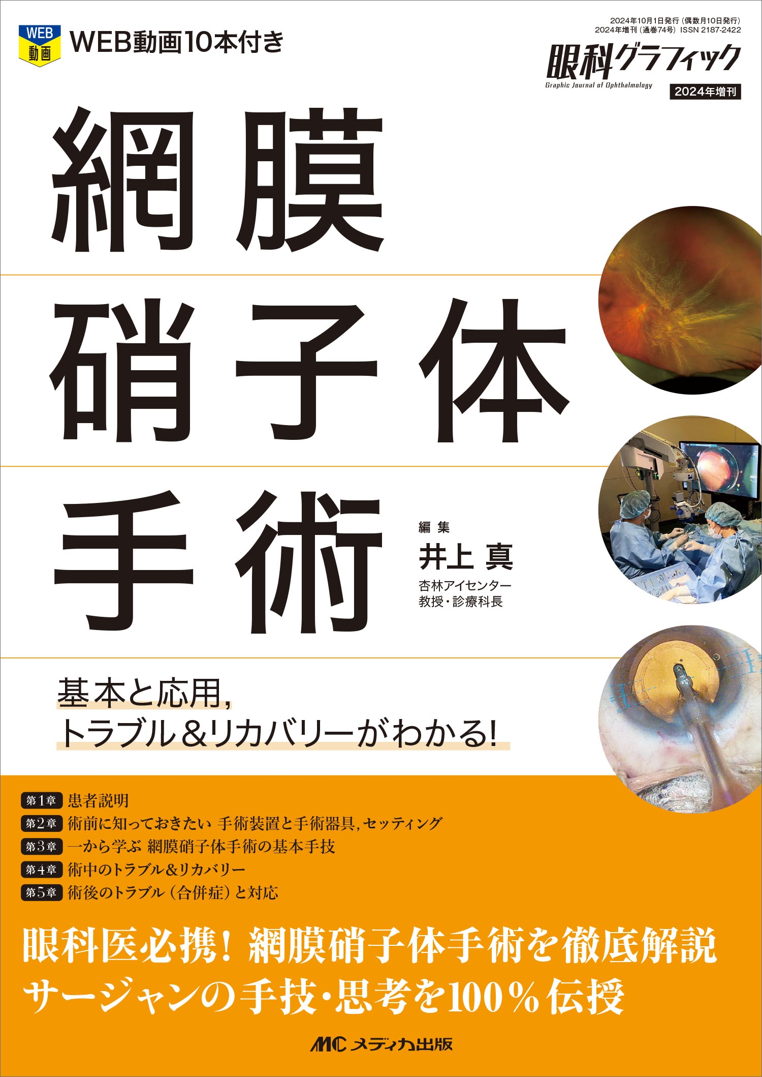 井上真/網膜硝子体手術 基本と応用,トラブル&リカバリーがわかる![9784840484411]