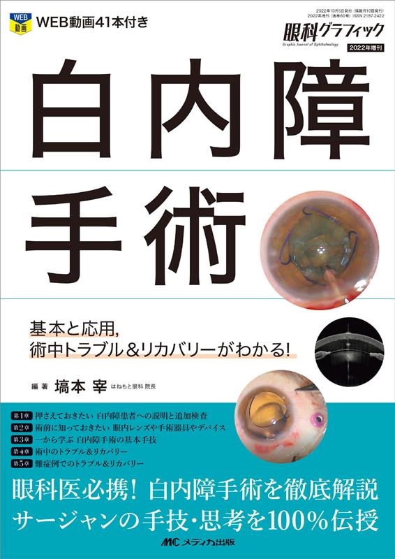 塙本宰/白内障手術 基本と応用術中トラブル&リカバリーがわかる! 眼科グラフィック2022年増刊[9784840478182]