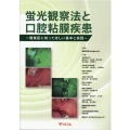 蛍光観察法と口腔粘膜疾患 開業医に知ってほしい基本と実践