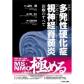 多発性硬化症・視神経脊髄炎診療のすべて