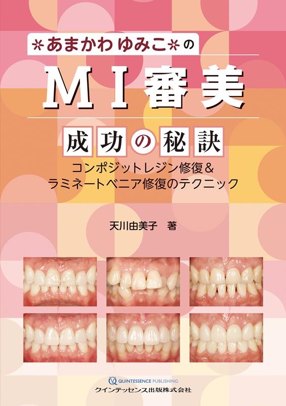Amazon.co.jp: あまかわゆみこのMI審美 成功の秘訣