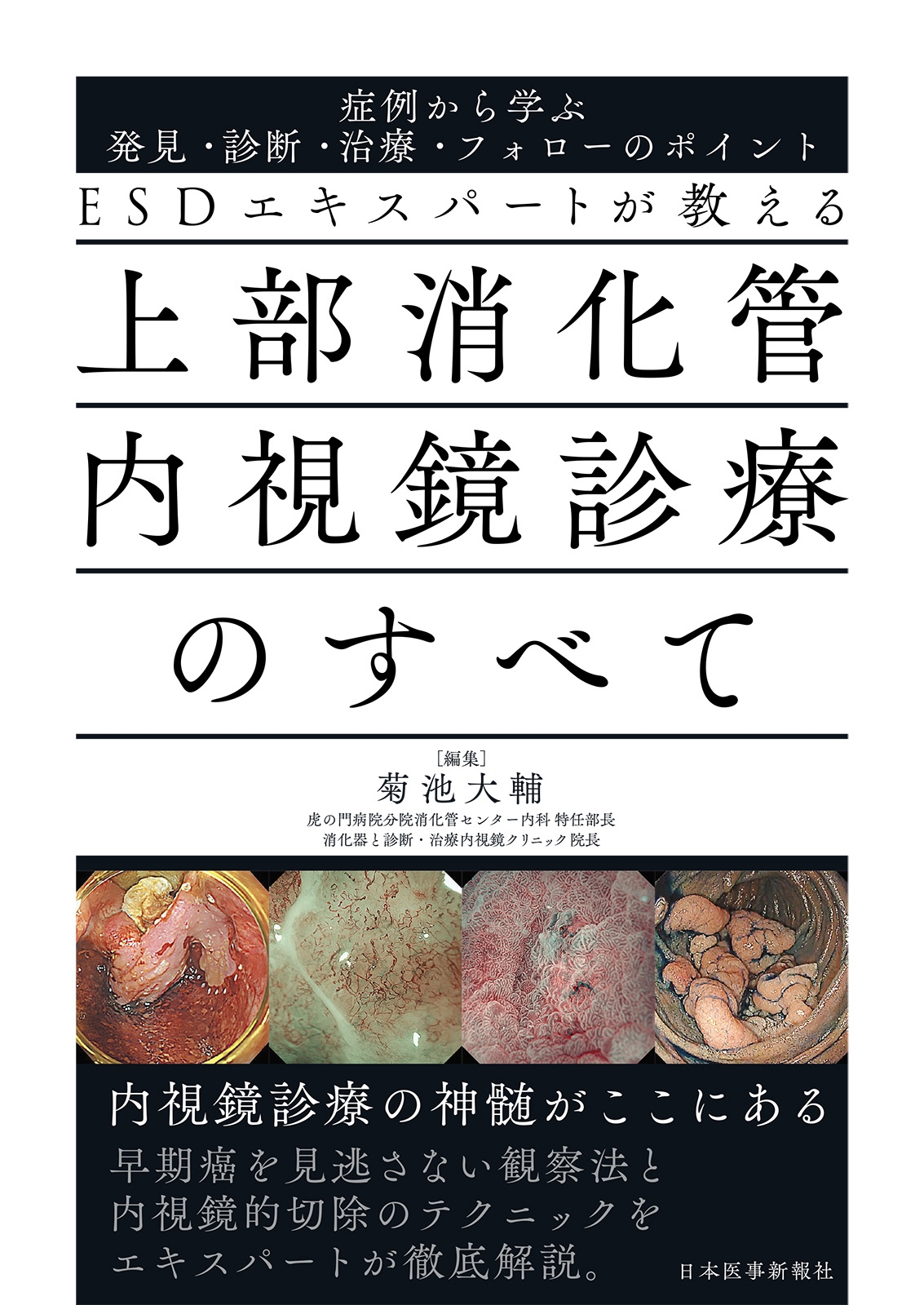 ESDエキスパートが教える 上部消化管内視鏡診療のすべて 症例から学ぶ発見・診断・治療・フォローのポイント ESDエキスパートが教える 上部消化管内視鏡診療のすべて 症例から学ぶ発見・診断・治療・フォローのポイント