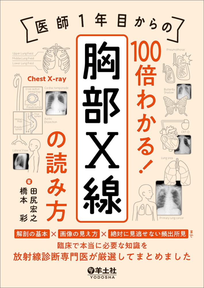 医師1年目からの 100倍わかる! 胸部X線の読み方 医師1年目からの 100倍わかる! 胸部X線の読み方