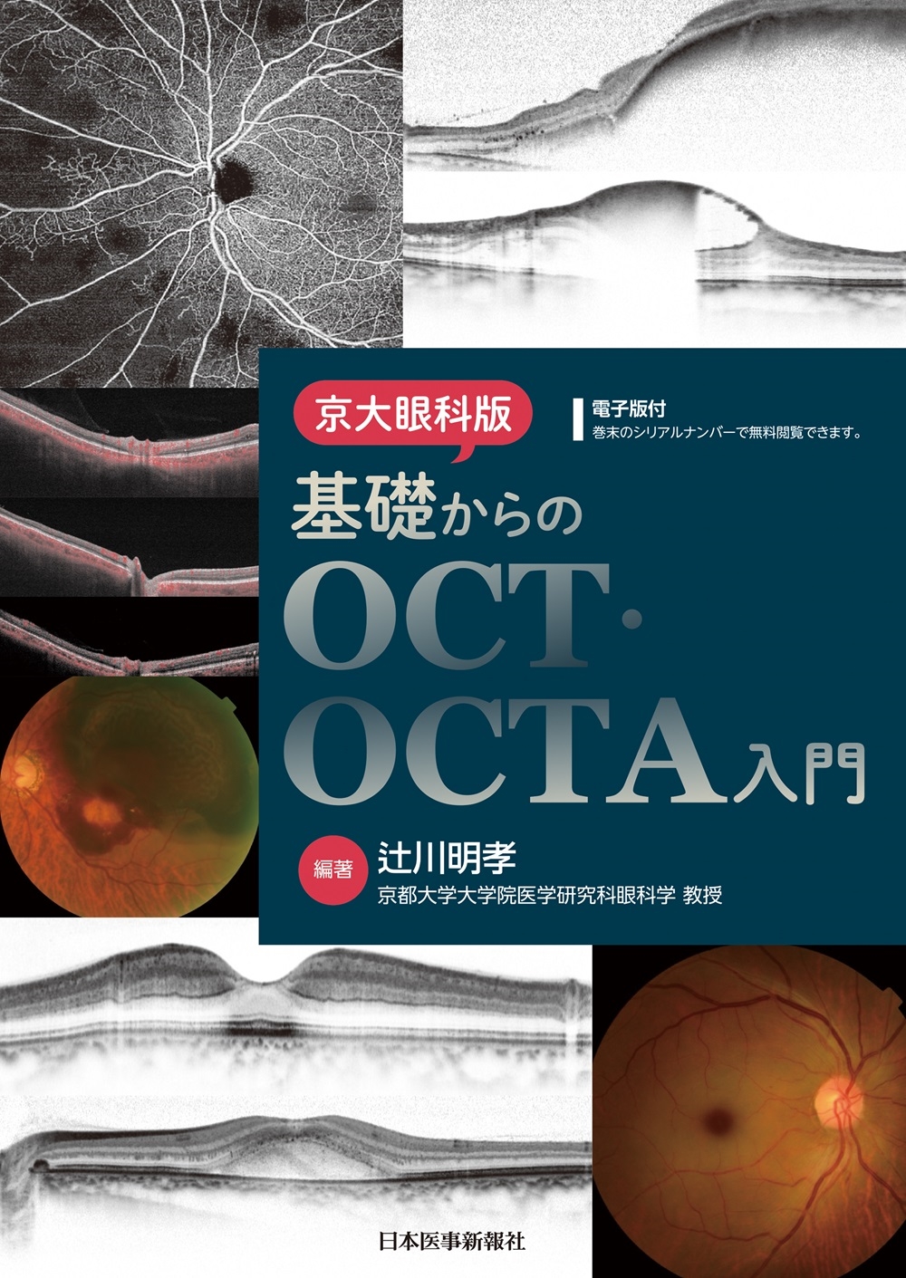 OCT・OCTA パーフェクト読影法 裁断済み 眼科