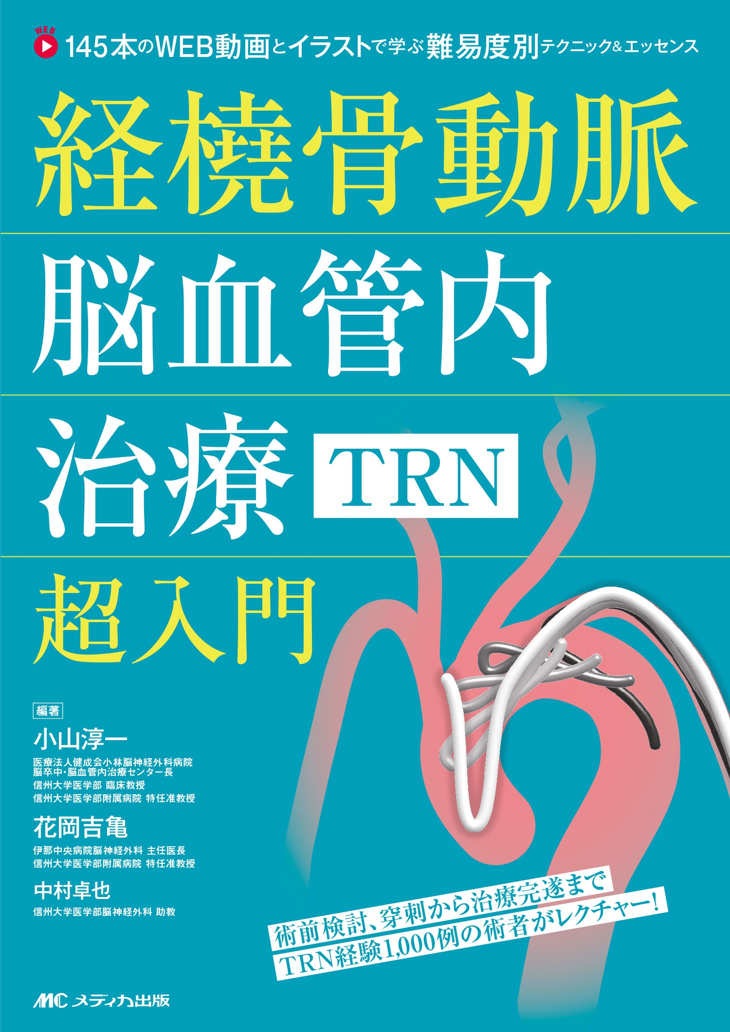 経橈骨動脈脳血管内治療(TRN)超入門 145本のWEB動画とイラストで学ぶ 難易度別テクニック&エッセンス