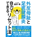 外反母趾と足底腱膜炎 自力でできるリセット法