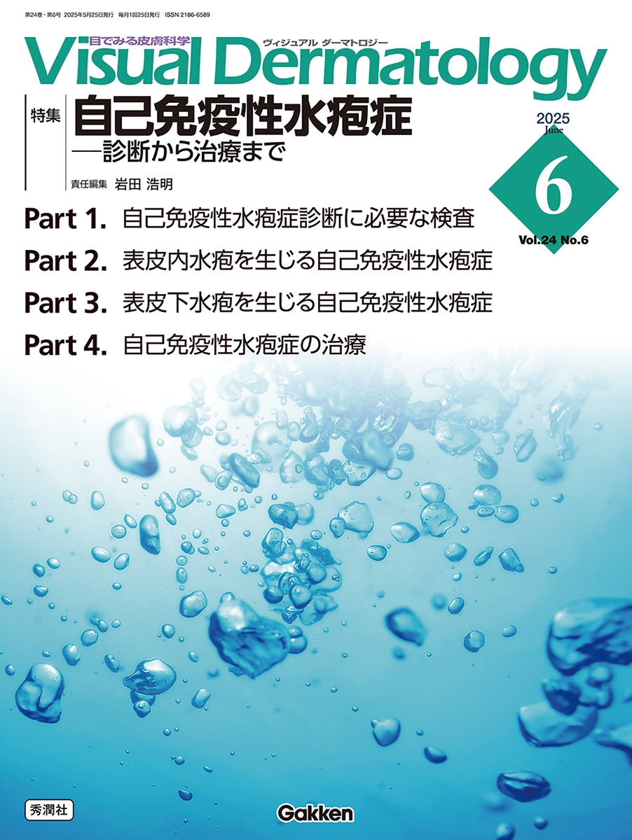 Visual D. 2025年6月号 Vol.24 No.6 自己免疫性水疱症ー診断から治療まで