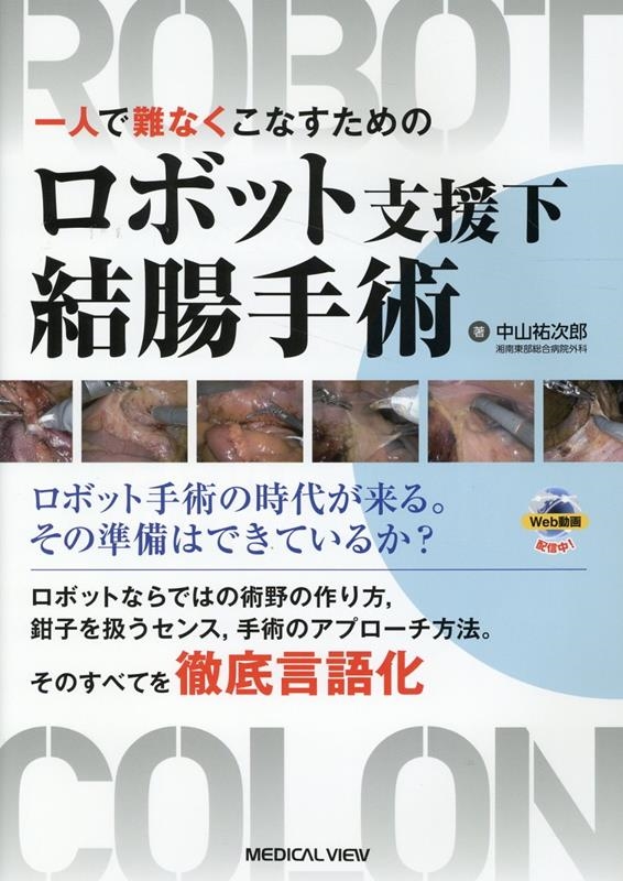 一人で難なくこなすための ロボット支援下結腸手術